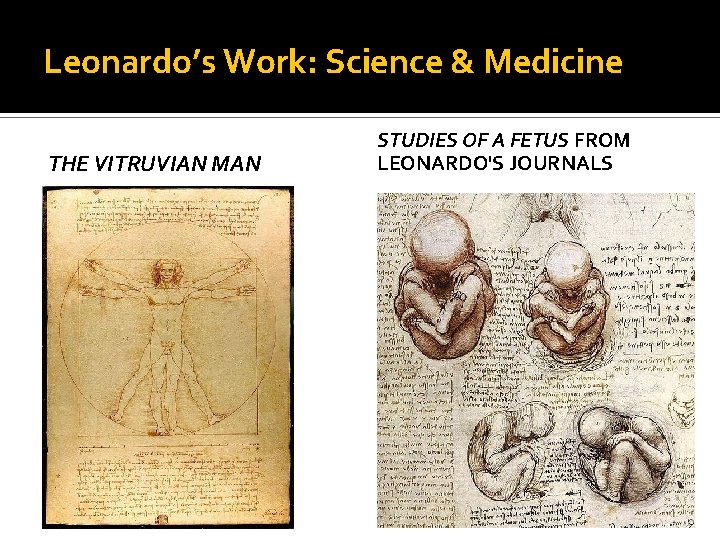 Leonardo’s Work: Science & Medicine THE VITRUVIAN MAN STUDIES OF A FETUS FROM LEONARDO'S