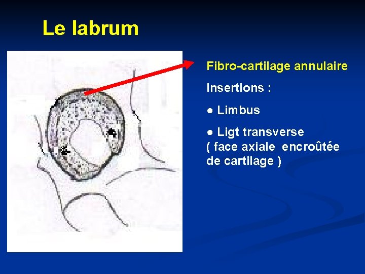 Le labrum Fibro-cartilage annulaire Insertions : ● Limbus ● Ligt transverse ( face axiale