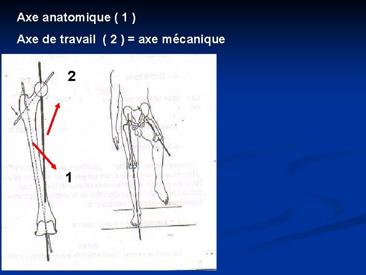 Axe anatomique ( 1 ) Axe de travail ( 2 ) = axe mécanique