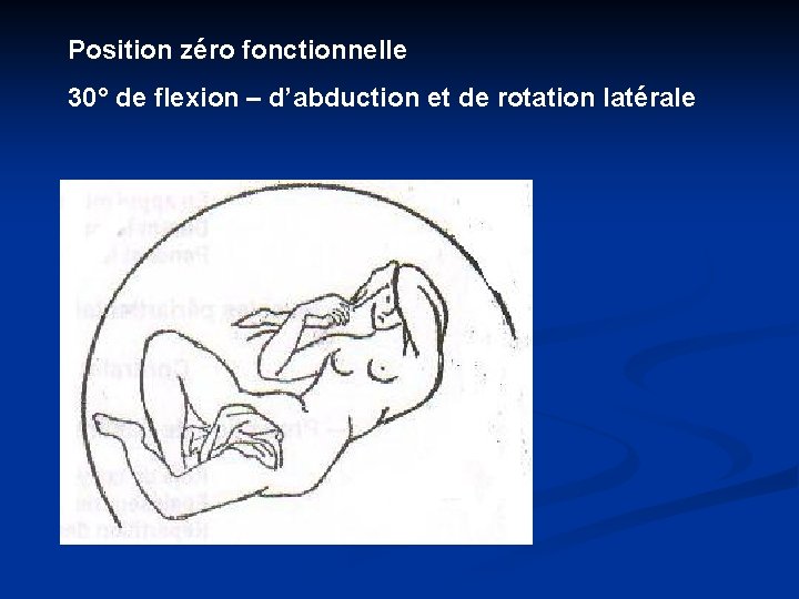 Position zéro fonctionnelle 30° de flexion – d’abduction et de rotation latérale 