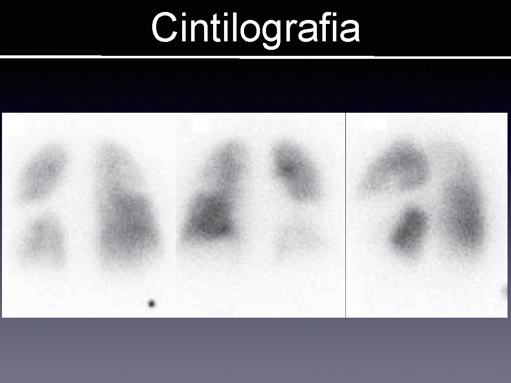 Cintilografia Imagens em TEP 