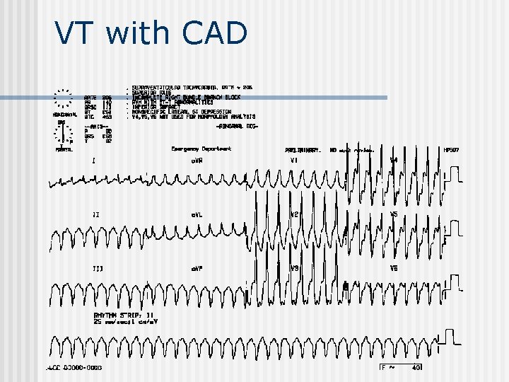 VT with CAD 