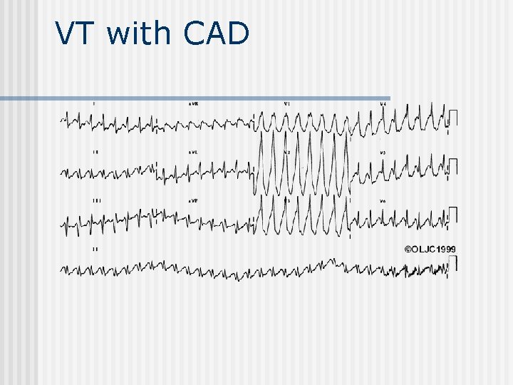 VT with CAD 