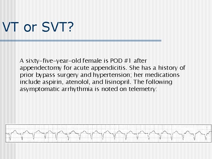 VT or SVT? A sixty-five-year-old female is POD #1 after appendectomy for acute appendicitis.