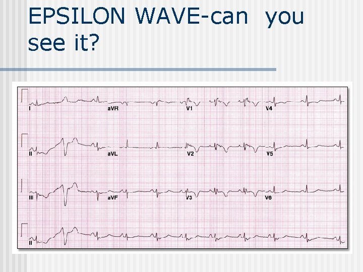 EPSILON WAVE-can you see it? 