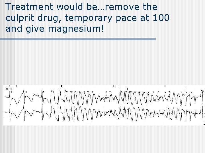 Treatment would be…remove the culprit drug, temporary pace at 100 and give magnesium! 