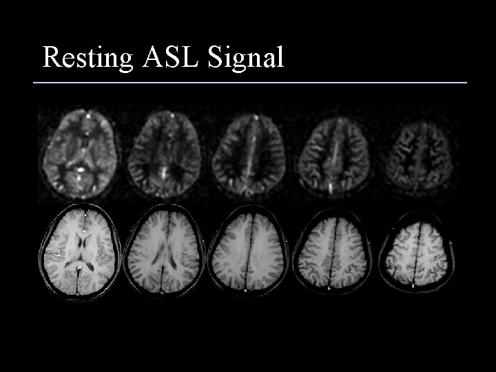 Resting ASL Signal 