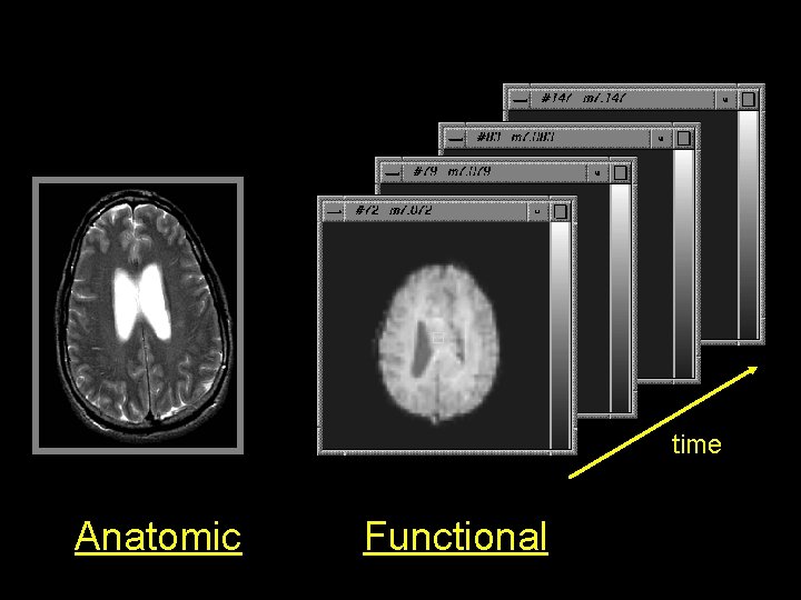 time Anatomic Functional 