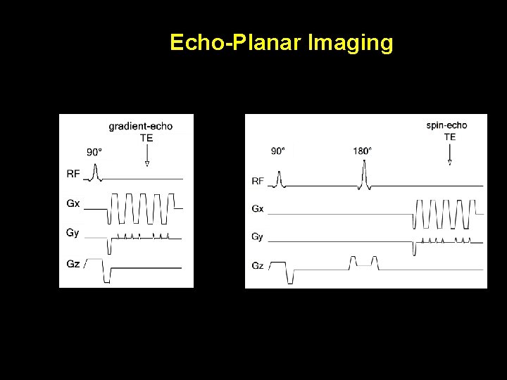 Echo-Planar Imaging 