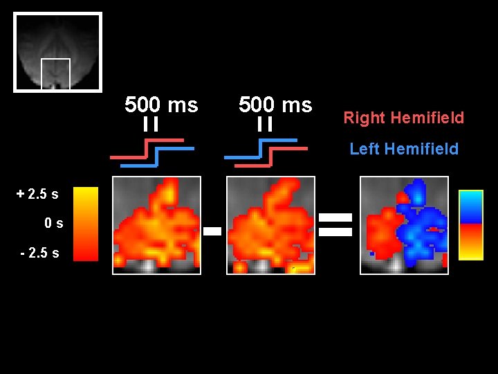 500 ms Right Hemifield Left Hemifield + 2. 5 s 0 s - 2.