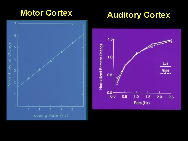 Motor Cortex Auditory Cortex 