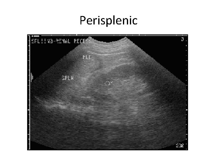 Perisplenic 