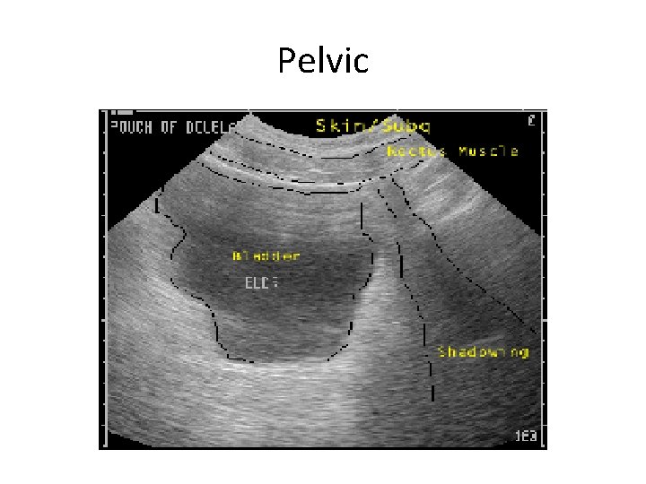 Pelvic 