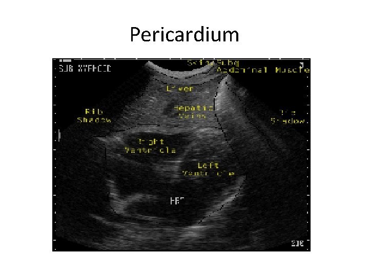 Pericardium 