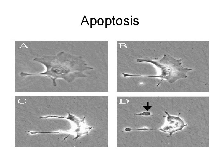 Apoptosis 