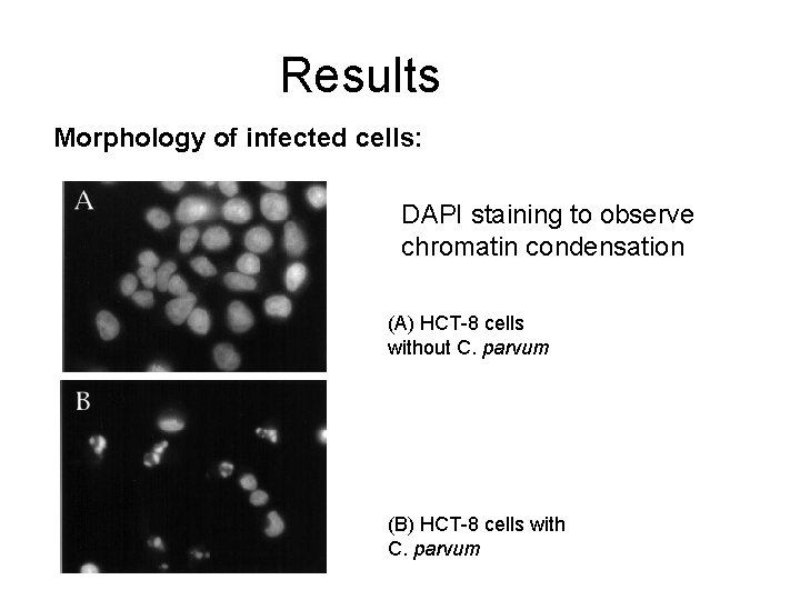 Results Morphology of infected cells: DAPI staining to observe chromatin condensation (A) HCT-8 cells