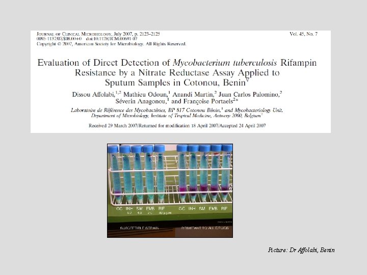 Picture: Dr Affolabi, Benin 