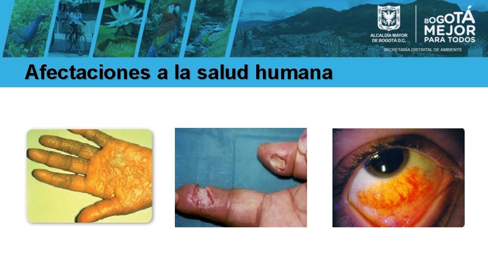 Afectaciones a la salud humana 