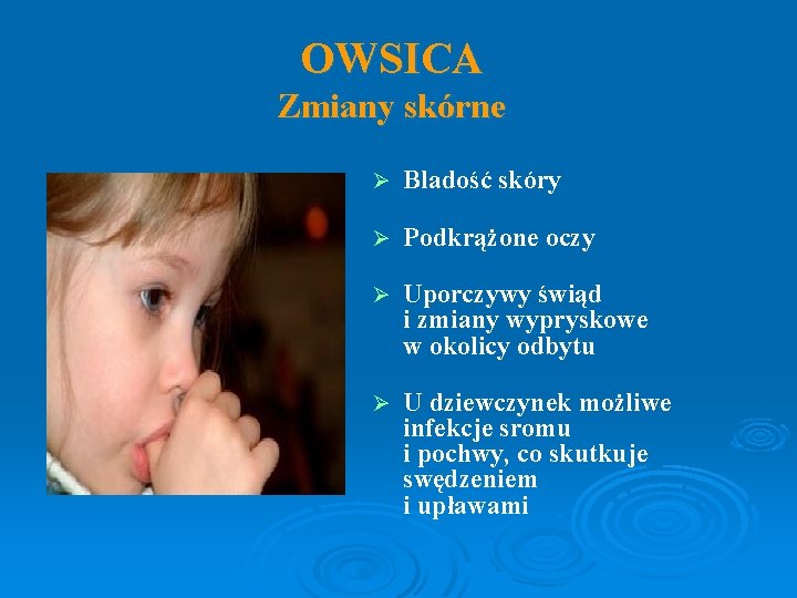 OWSICA Zmiany skórne Bladość skóry Ø Podkrążone oczy Ø Ø Uporczywy świąd i zmiany