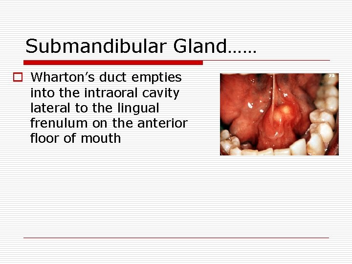 Salivary Glands Disorders Anatomical Considerations o Two submandibular