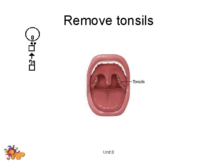 Remove tonsils Unit 8 