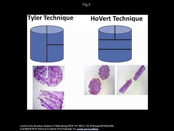 Fig 5 Journal of the American Academy of Dermatology 2016 741 -16 DOI: (10.