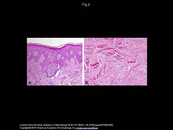 Fig 6 Journal of the American Academy of Dermatology 2016 741 -16 DOI: (10.