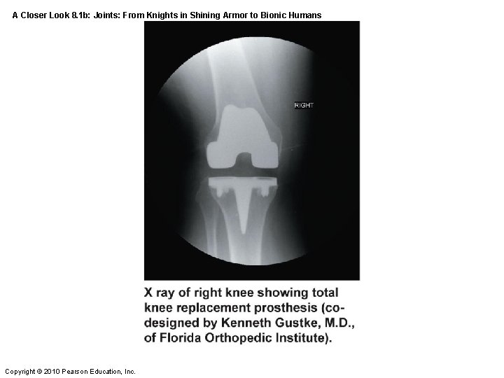 A Closer Look 8. 1 b: Joints: From Knights in Shining Armor to Bionic