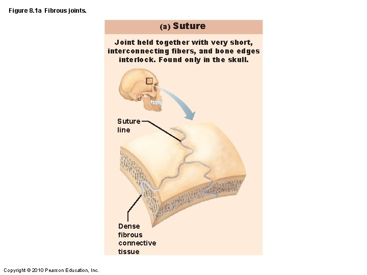 Figure 8. 1 a Fibrous joints. (a) Suture Joint held together with very short,