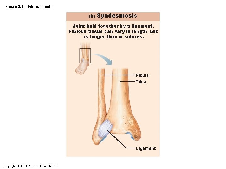Figure 8. 1 b Fibrous joints. (b) Syndesmosis Joint held together by a ligament.