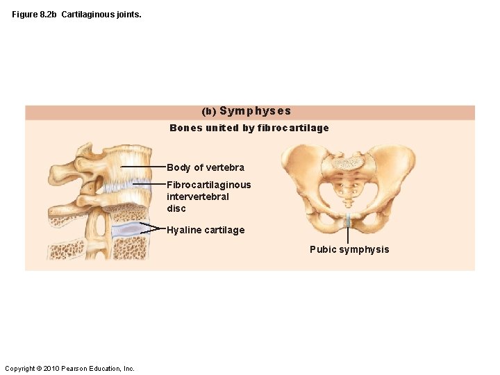 Figure 8. 2 b Cartilaginous joints. (b) Symphyses Bones united by fibrocartilage Body of