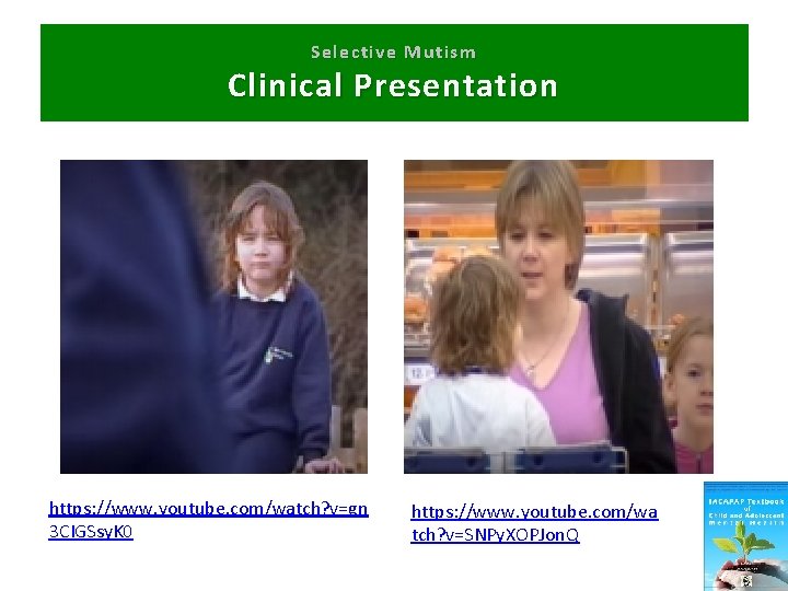 Selective Mutism Clinical Presentation https: //www. youtube. com/watch? v=gn 3 CIGSsy. K 0 https: