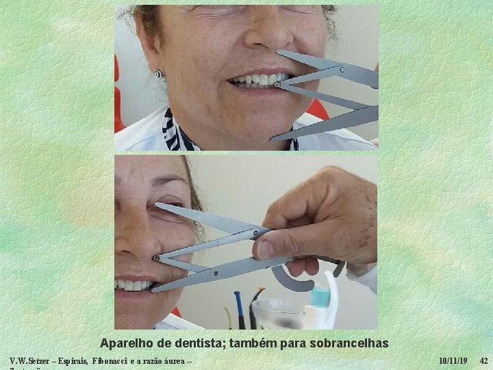 Aparelho de dentista; também para sobrancelhas V. W. Setzer – Espirais, Fibonacci e a