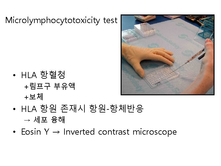 Microlymphocytotoxicity test • HLA 항혈청 +림프구 부유액 +보체 • HLA 항원 존재시 항원-항체반응 →