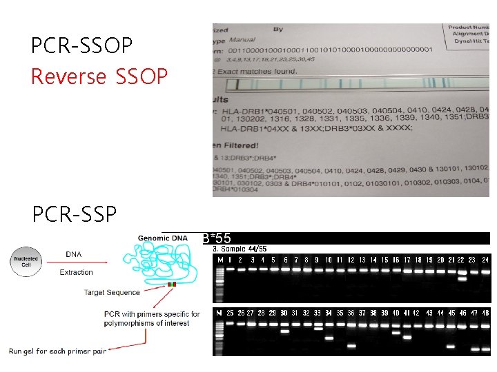 PCR-SSOP Reverse SSOP PCR-SSP B*44/B*55 
