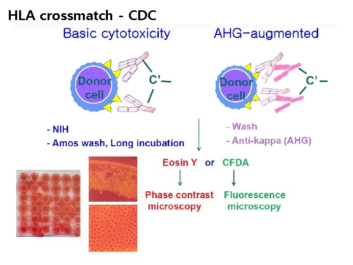 HLA crossmatch - CDC 