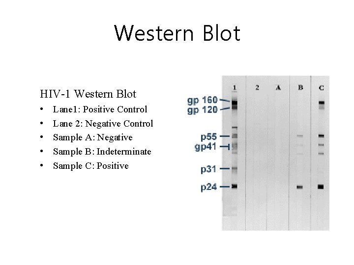Western Blot HIV-1 Western Blot • • • Lane 1: Positive Control Lane 2: