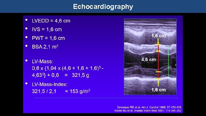 Echocardiography 