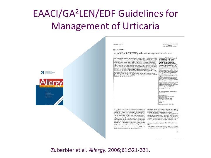EAACI/GA 2 LEN/EDF Guidelines for Management of Urticaria Zuberbier et al. Allergy. 2006; 61: