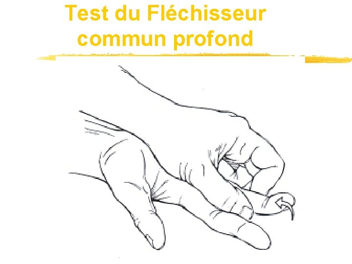 Test du Fléchisseur commun profond 