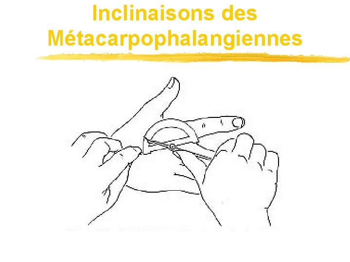 Inclinaisons des Métacarpophalangiennes 