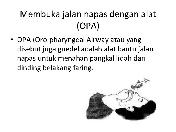 Membuka jalan napas dengan alat (OPA) • OPA (Oro-pharyngeal Airway atau yang disebut juga