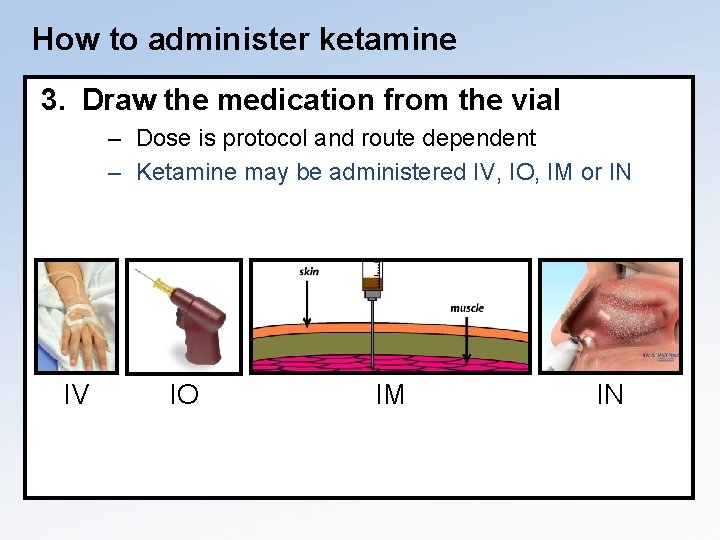 How to administer ketamine 3. Draw the medication from the vial – Dose is