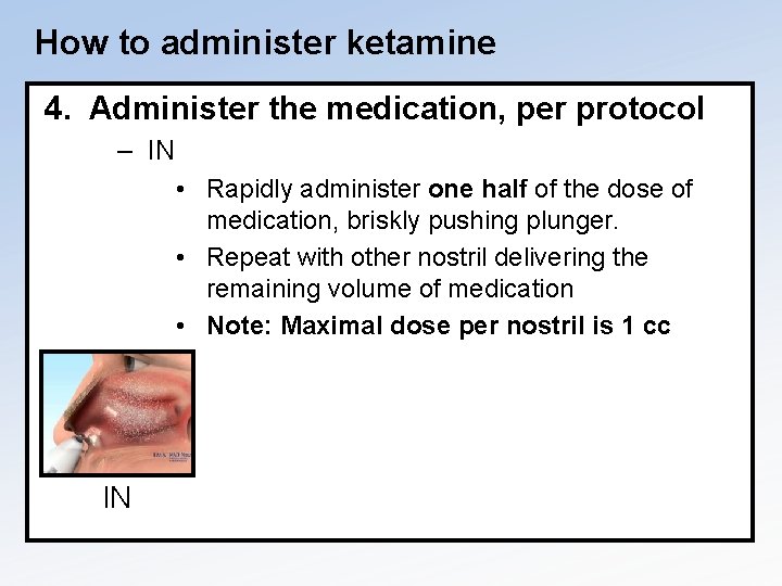 How to administer ketamine 4. Administer the medication, per protocol – IN • Rapidly