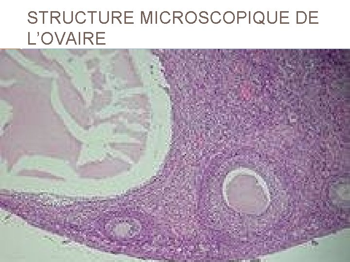 STRUCTURE MICROSCOPIQUE DE L’OVAIRE Du « charmant kyste de l’ovaire » versus le fibrome