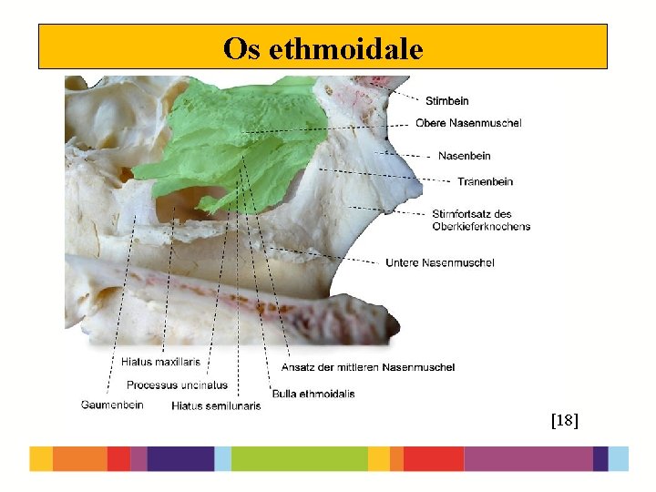 Os ethmoidale [18] 