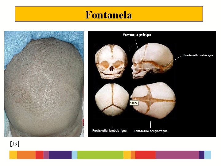 Fontanela [19] 