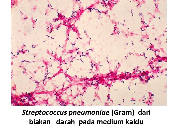 Streptococcus pneumoniae (Gram) dari biakan darah pada medium kaldu 