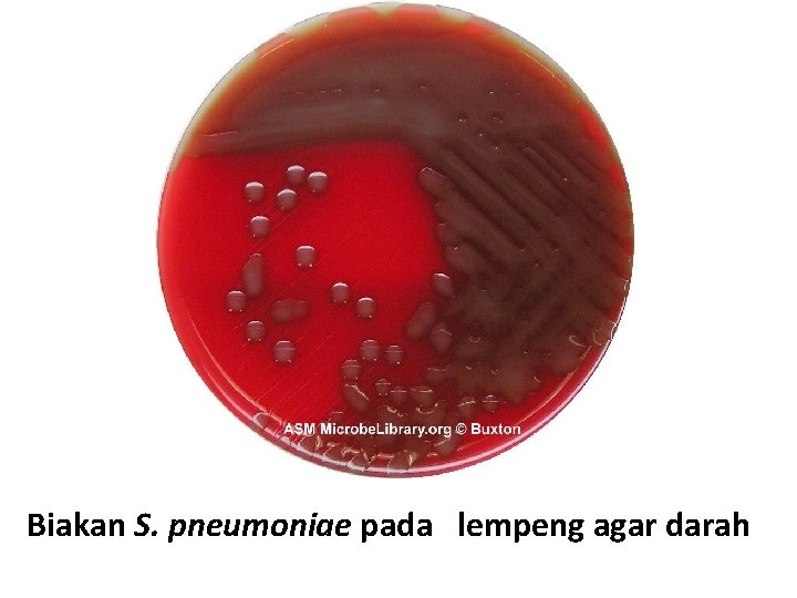 Biakan S. pneumoniae pada lempeng agar darah 