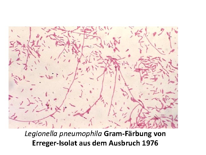 Legionella pneumophila Gram-Färbung von Erreger-Isolat aus dem Ausbruch 1976 